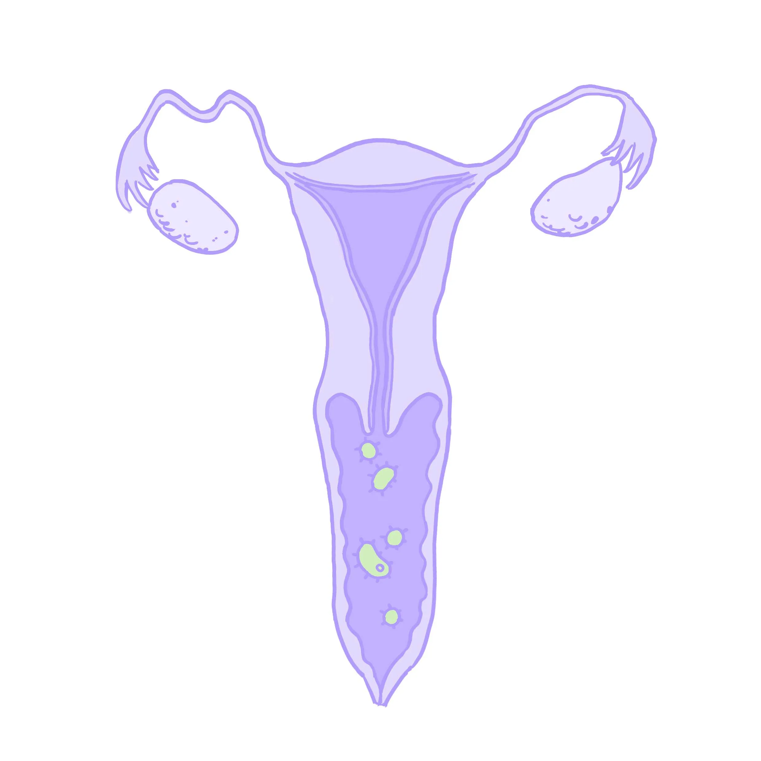 Bakteriell vaginos illustration av Hormonology.