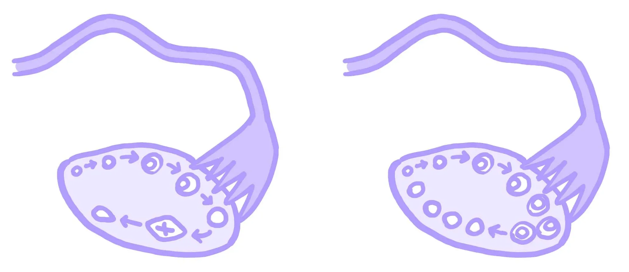 Illustration av pärlband i äggstockarna vid PCO/PCOS, av Hormonology.